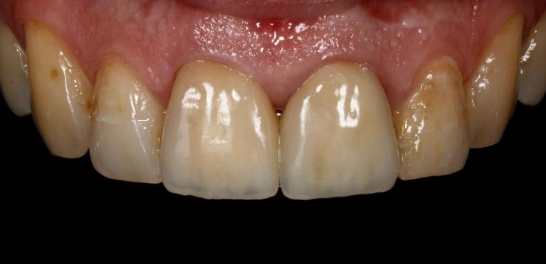 Cosmetic-Dentistry-After-Image