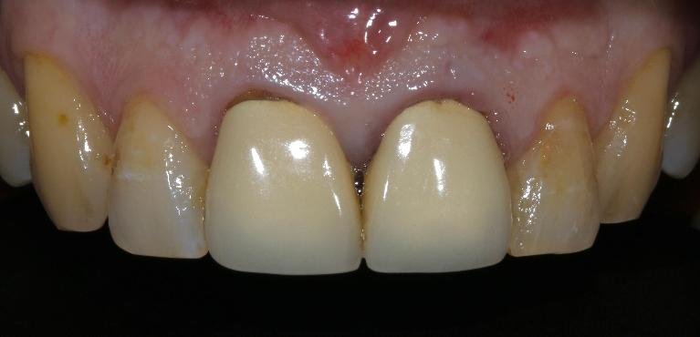 Cosmetic-Dentistry-Before-Image